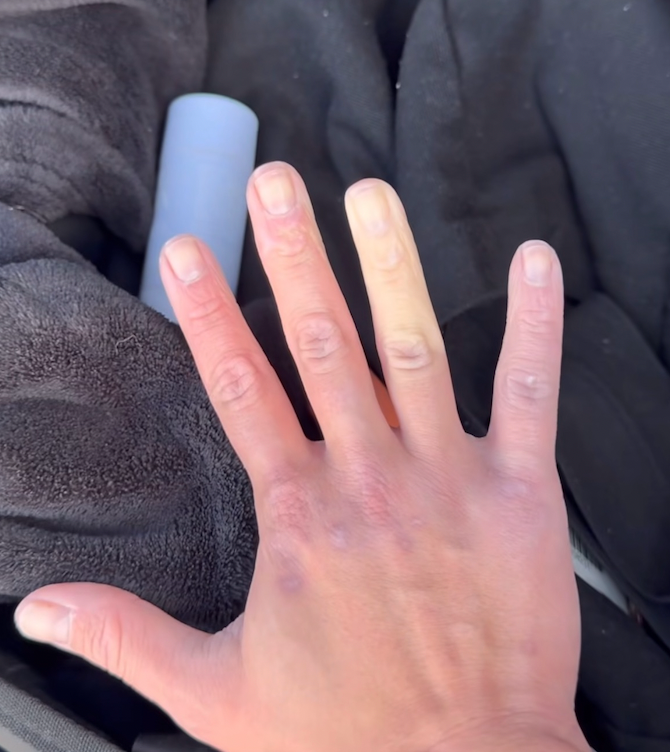 How to Keep Your Hands Warm in Winter: 11 Ways That Actually Work